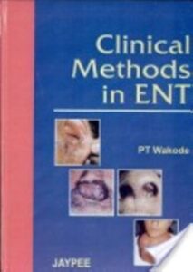 Clinical Method in ENT PT Wakode medicalstudyzone